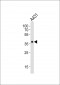 MUL1 Antibody (Center)
